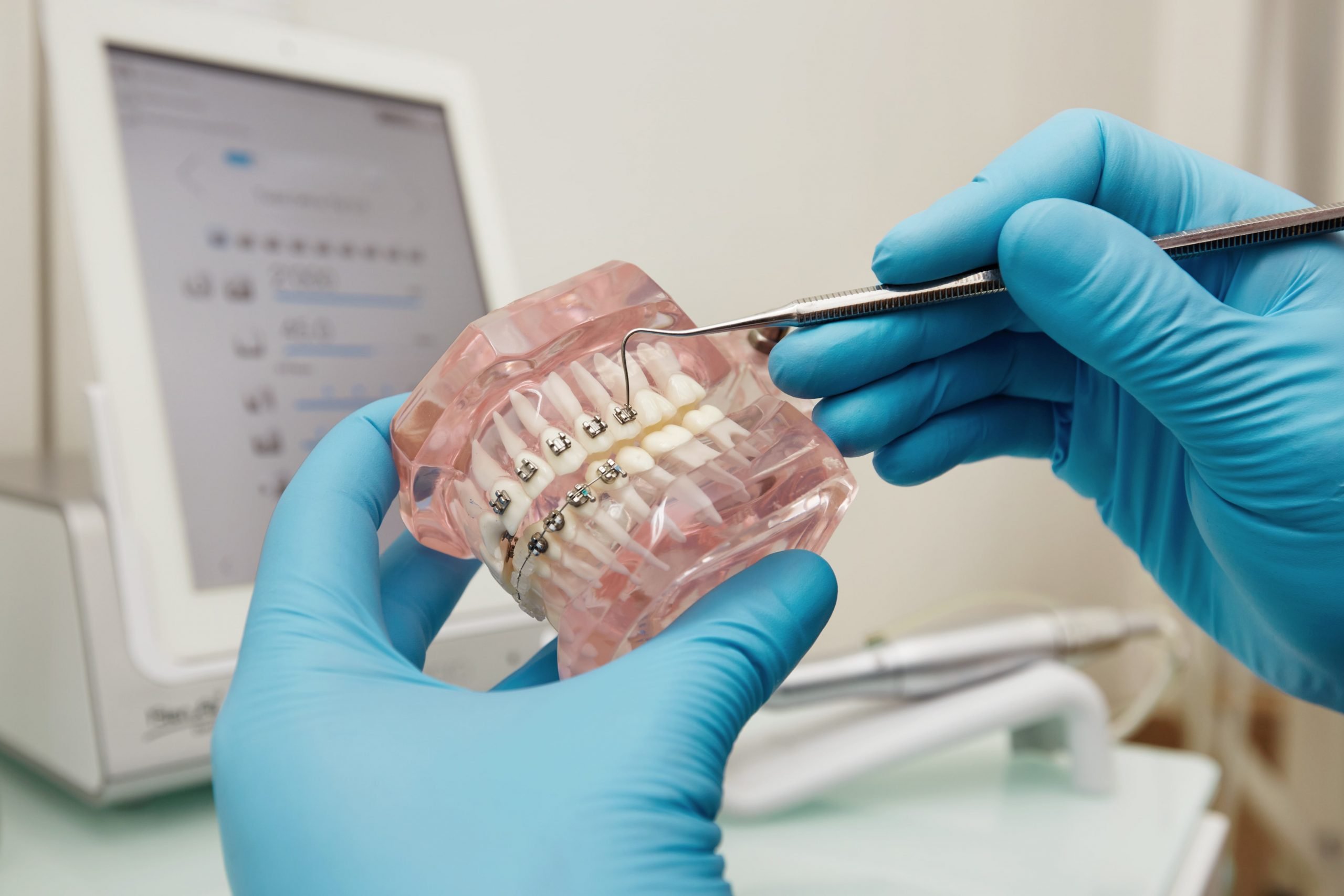 orthodontics treatment